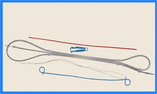 Polyurethane Ureteral Indwelling Double Pigtail Stent Set
