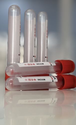 Plain Serum Vacuum Blood Collection Tube, Color : Transparent