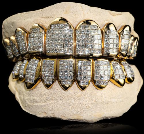 Sterling Silver Hip Hop Iced out Moissanite Diamond Grillz