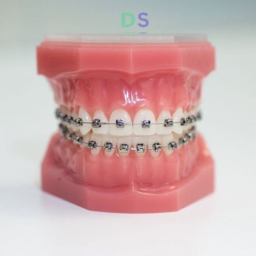 Orthodontic Treatment Services