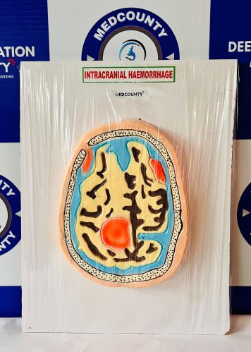 Hsn Fiber/resin Medcounty Intracranial Haemorrhage Brain Model