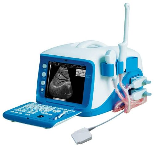 Portable Digital Ultrasound Scanner