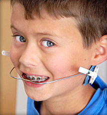 Orthodontics Appliance