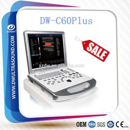 Digital Ultrasound Scanner
