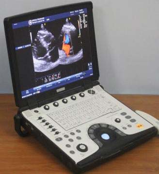 GE Voluson Portable Ultrasound Machine (VIVID E)