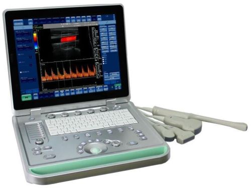 Sonostar Cheap Doppler Ultrasound Mobile Color Doppler Ultrasound Mach