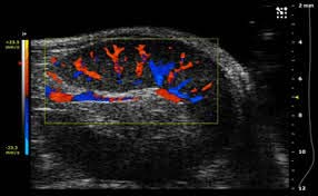 Electric 10-50kg Color Doppler Machine, Voltage : 110V, 220V