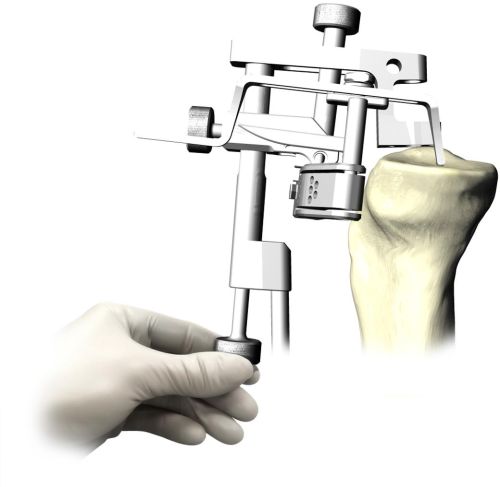 Surgical instruments, Material : Stainless Steel