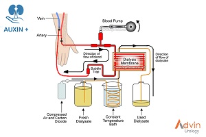 Haemodialysis Dry Powder