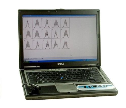 Stress Analyzer