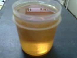 Epoxy Resin Hardener