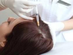 Hair Fall Treatment