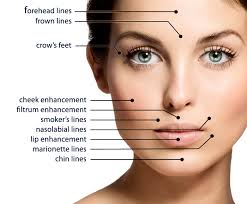 Cosmetic Fillers