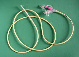 Nasogastric Tube