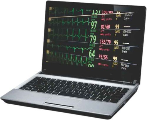 VITAL SIGN MONITORING