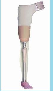 Transfemoral Preparatory Prosthesis