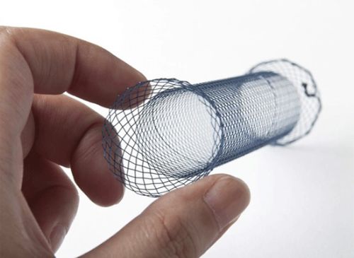 Esophageal Metal Stent