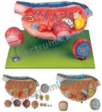 Ovary Model