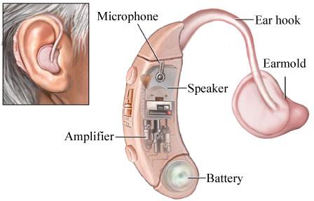 Arphi Hearing Aids, Feature : Direct Audio Input, Low Battery Consumption