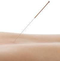 Acupuncture Needle