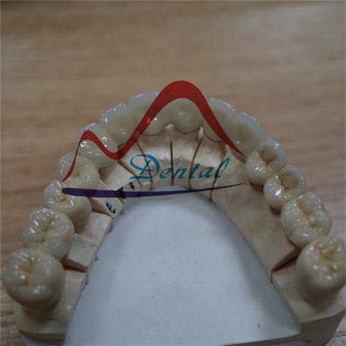 Antomical Dental Non Precious PFM Bridge