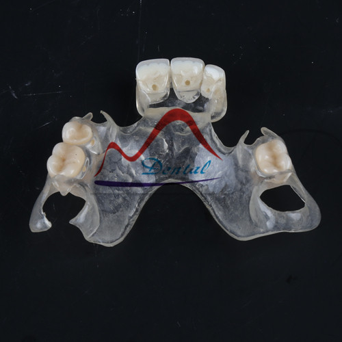 Clear Flexible Partial Removable Denture