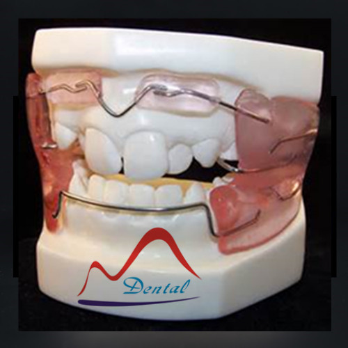 Frankel Orthodontic Dental Appliance