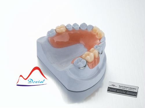 Good Quality Partial Acrylic Denture