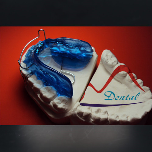 The Bionator Orthodontic Appliances