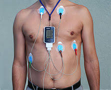 Holter Monitor