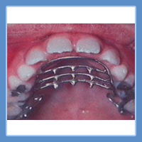 Orthodontics Brackets