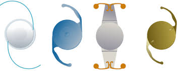 Intraocular Lenses