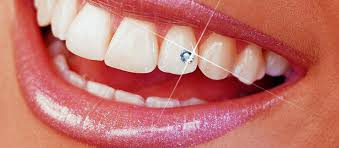 Tooth Jewellery