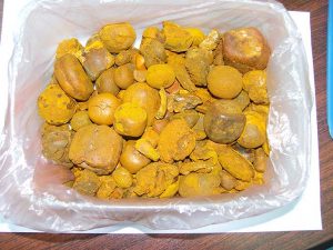 Ox Gallstones, Purity : 99%