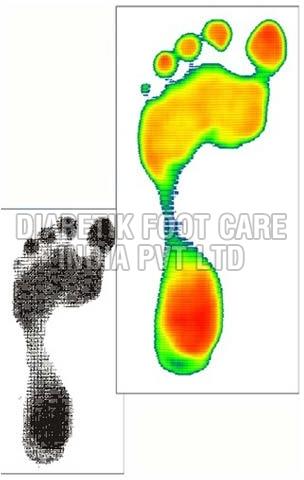 Simple Plantar Pressure System (Podiascan)