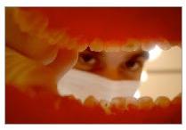 Tooth Replacement Services