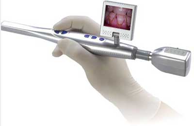 Wireless Intraoral Camera (pd 800uwsl)