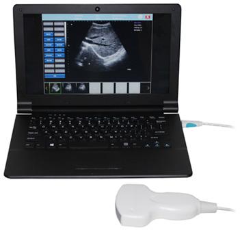 Sonostar Laptop PC Based High Quality Medical For Sale UBook-8
