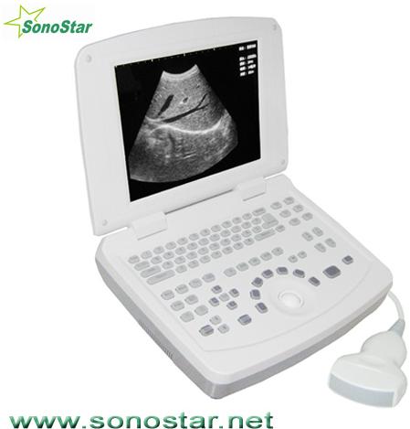 SS-3 Laptop Ultrasound B Scanner