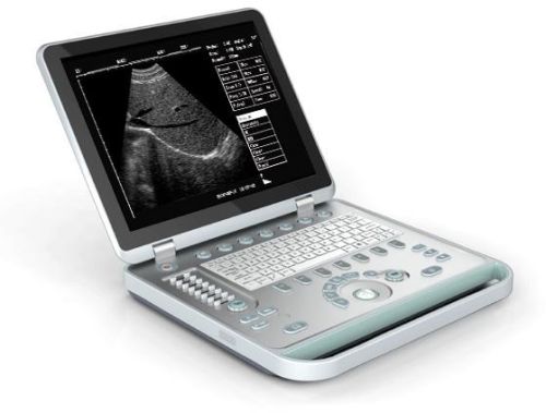 Laptop Ultrasound Scanner