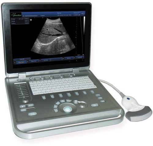 PC Based Laptop Ultrasound B Scanner