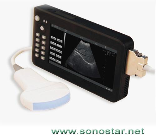 Upad-2 Tablet Palm Ultrasound B Scanner