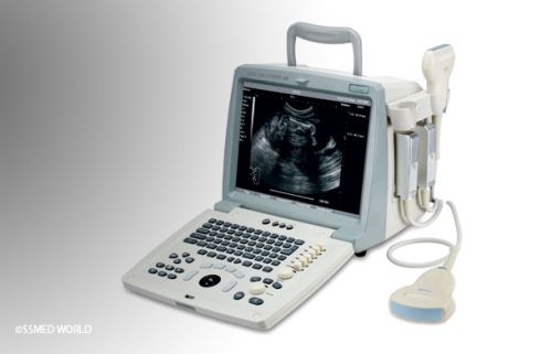 Electric Portable Ultrasound Machine, For Hospital Use, Clinical Use, Machine Type : Doppler, 4D, 3D