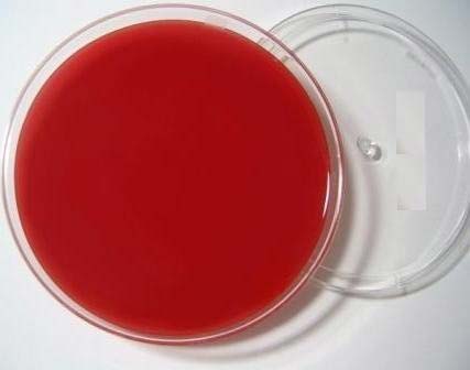 Sheep Columbia Blood Agar Plates (14x1) CA002