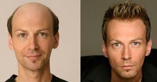 Hair Weaving Service