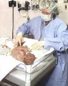 Disposable Delivery Kit, For Clinical, Home Purpose, Hospital, Packaging Type : Catron