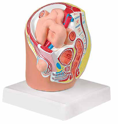 Indirect Inguinal Hernia Model