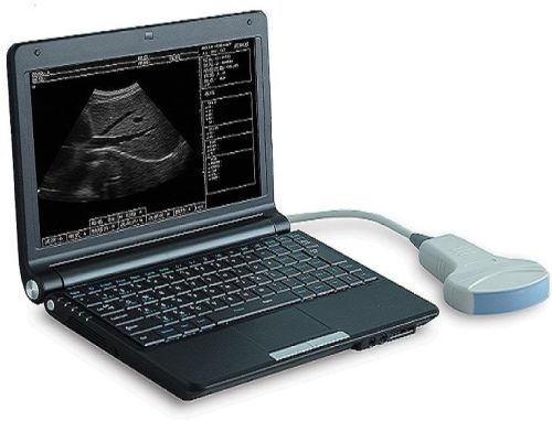 Sw-1200a Digital Ultrasound Scanner