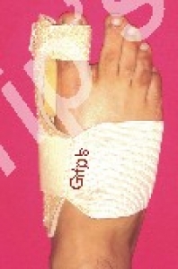 Bunion Night Splint
