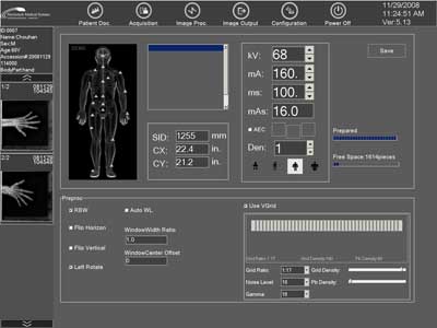 Computed Radiography System